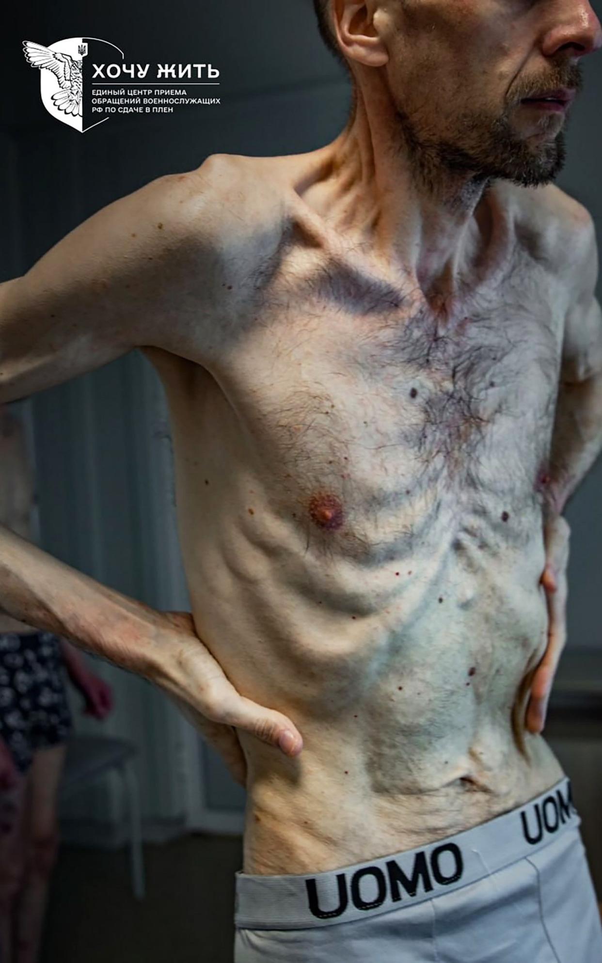 Mr Gorilyk's skin clings to his sunken stomach and ribs as he stands