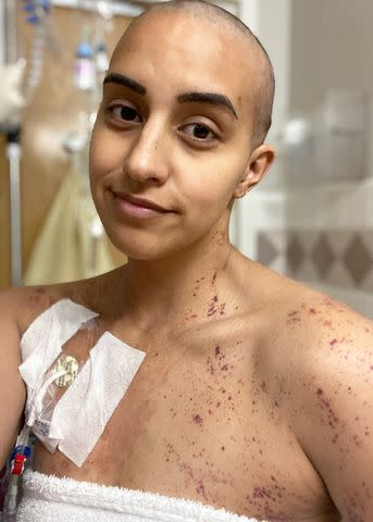 <p>Tia Stokes</p> Tia Stokes poses with a port in her chest in the hospital