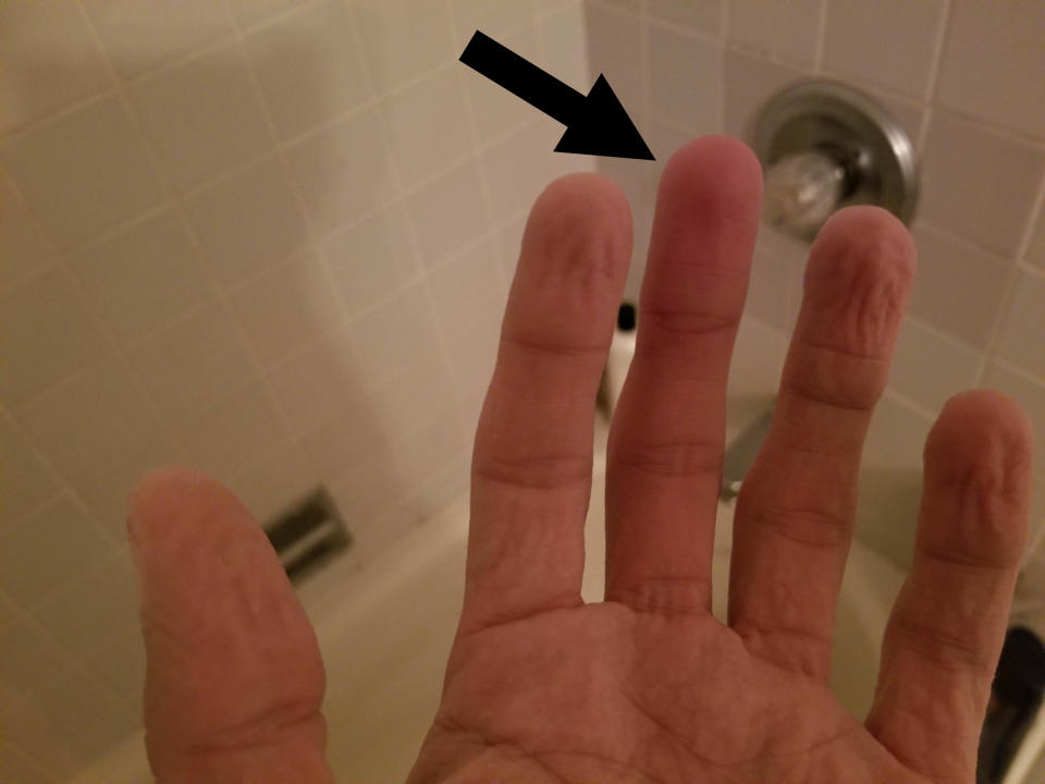 A water-wrinkled hand except for one finger