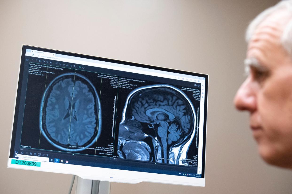 A brain scan is pulled up on a computer screen while Dr. Geoffrey Eubank listens to patient Janet Tharp during an appointment Wednesday at OhioHealth Riverside Methodist Hospital.