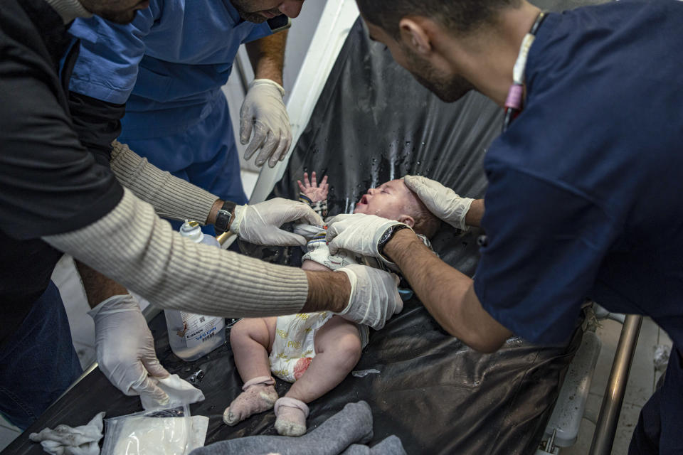 FILE - A Palestinian baby wounded in Israeli bombardment of the Gaza Strip is treated in a hospital in Khan Younis on Dec. 1, 2023. The war in Gaza has sparked a humanitarian catastrophe that has prompted shortages of the most basic necessities. Among those hardest hit are babies, young children and their parents. That's because diapers and formula are hard to find or have prices that are increased to unaffordable prices. Parents are looking to inadequate or even unsafe alternatives. (AP Photo/Fatima Shbair, File)