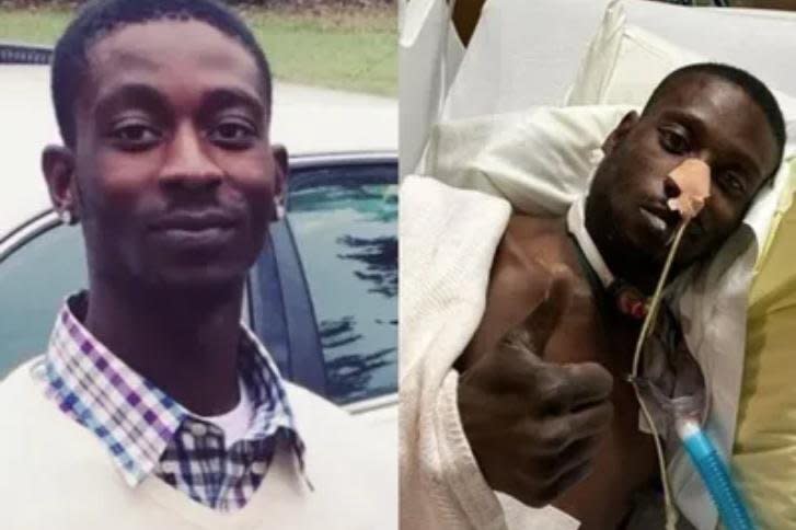 Michael Corey Jenkins (pictured before and after the assault committed by six former Rankin County Mississippi deputies) is one of 2 victims in the incident. A fifth deputy, Brett McAlpin, was sentenced Thursday to 27 years in prison for his role in the attack. Photo courtesy of Black Lawyers For Justice.