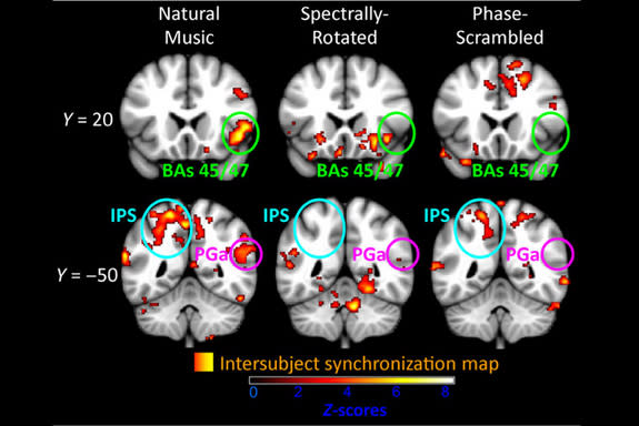 These fMRI images show areas of the fronto-parietal cortex that responded in similar ways across study participants as they listened to three variations of a symphony. Synchronization was strongest when participants listened to the original, un