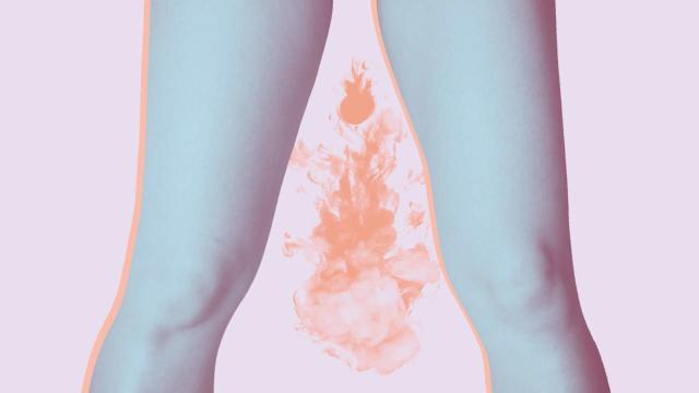 My Vagina Stinks – Why? - Bedford Commons