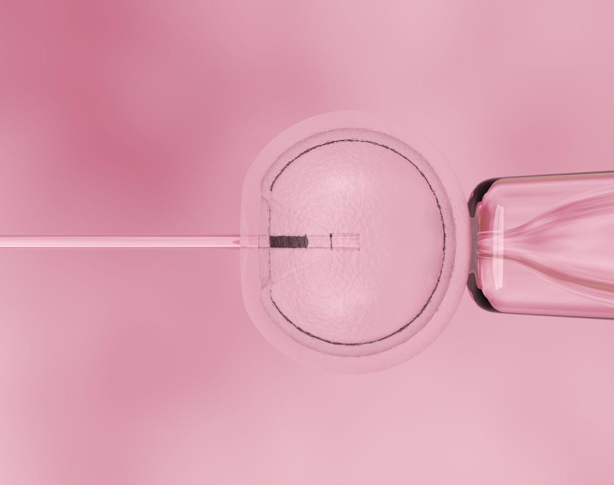 In vitro fertilization, IVF macro concept