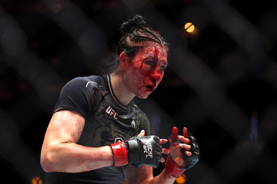 Irene Aldana sports a gruesome cut on her head in her loss to Norma Dumont (Getty Images)