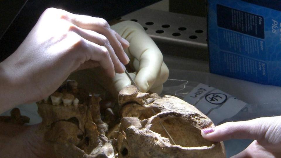 Scientists probe the skull of Richard III to identify the blow that killed him in battle (University of Leicester/PA)