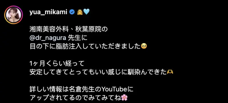 ▲三上悠亞透露在眼下注射脂肪，經過1個月休養，目前狀態良好。（圖／三上悠亞IG）