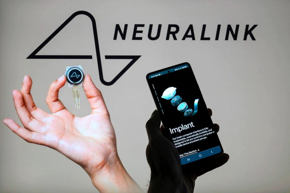 PHOTO: The Neuralink web site is displayed on a smartphone with Neuralink logo visible in the background in this photo illustration, on May 13, 2024, in Brussels, Belgium. (Jonathan Raa/Sipa USA via AP)