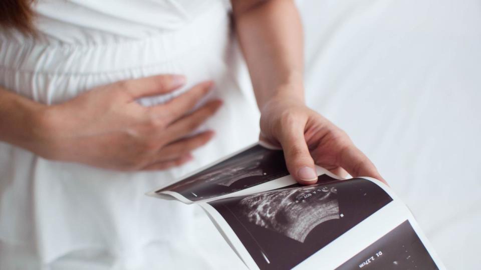 A pregnant woman is holding an ultrasound scan result