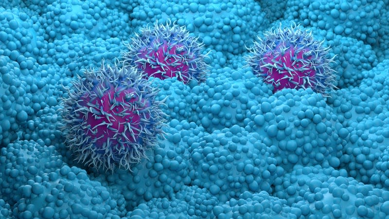 A 3D illustration of pancreatic cancer cells. - Illustration: Nemes Laszlo (Shutterstock)