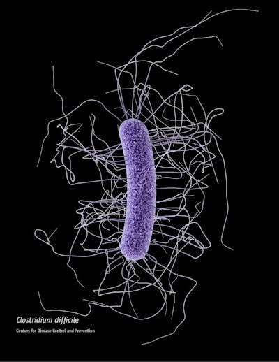 La bacteria ‘Clostridium difficile’. <a href="https://upload.wikimedia.org/wikipedia/commons/b/b7/Clostridium_difficile_CDC.jpg" rel="nofollow noopener" target="_blank" data-ylk="slk:CDC / Wikimedia Commons;elm:context_link;itc:0;sec:content-canvas" class="link ">CDC / Wikimedia Commons</a>, <a href="http://creativecommons.org/licenses/by/4.0/" rel="nofollow noopener" target="_blank" data-ylk="slk:CC BY;elm:context_link;itc:0;sec:content-canvas" class="link ">CC BY</a>