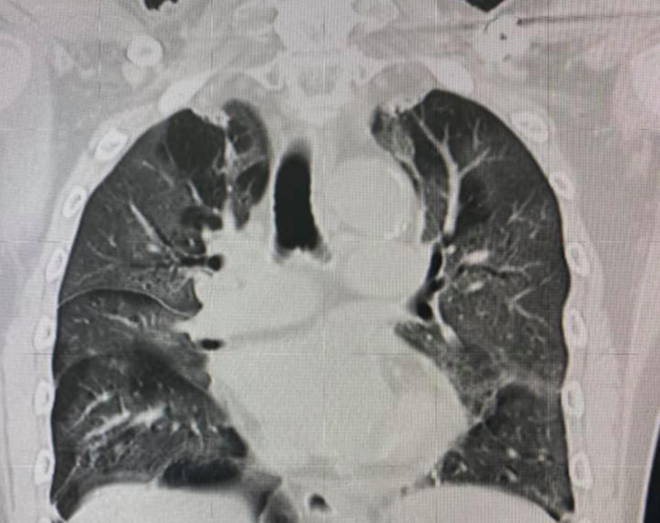 柯世祐憂心再1、2個禮拜雙北的ECMO（葉克膜）會否就用完？沉痛表示「我彷彿就坐在奈何橋旁，目擊著一個一個走上橋的人」。（圖片翻攝FB/Shih Yu Ko）