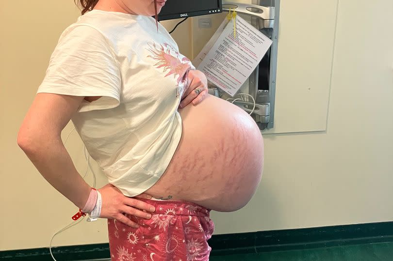 Arlene pregnant