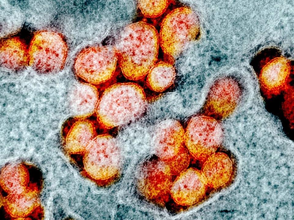 Four people were reported dead due to the virus on Sunday in New Brunswick. (NIAID Integrated Research Facility/Reuters - image credit)