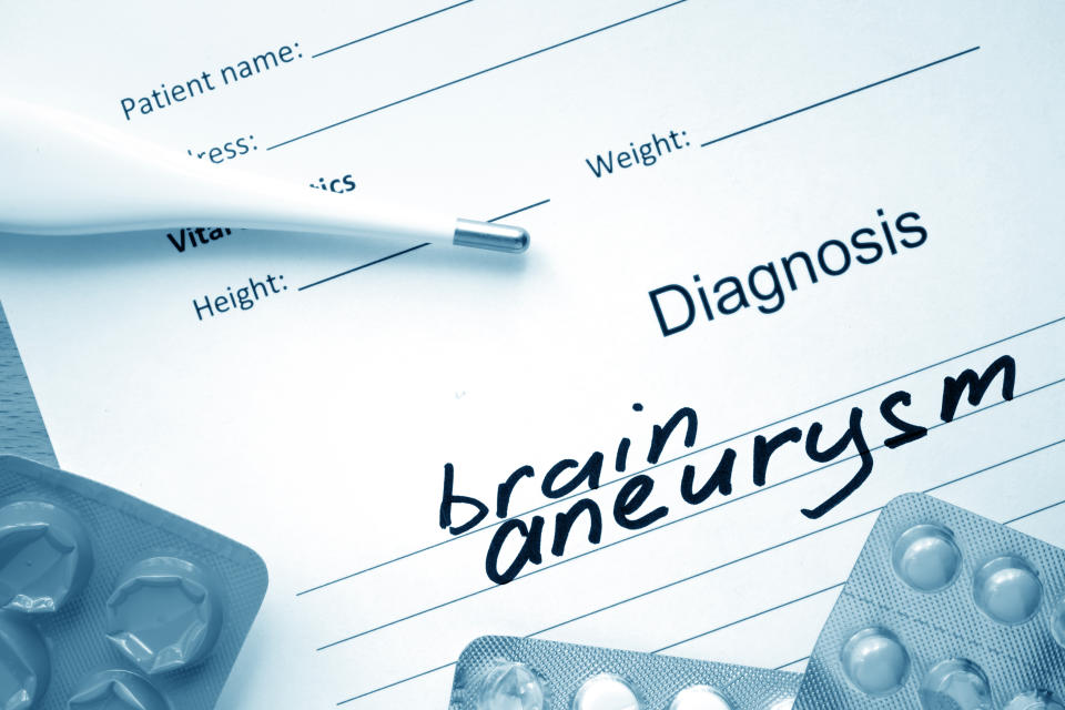 Diagnosis brain aneurysm and tablets. Medicine concept. A ruptured aneurysm is often described as the 