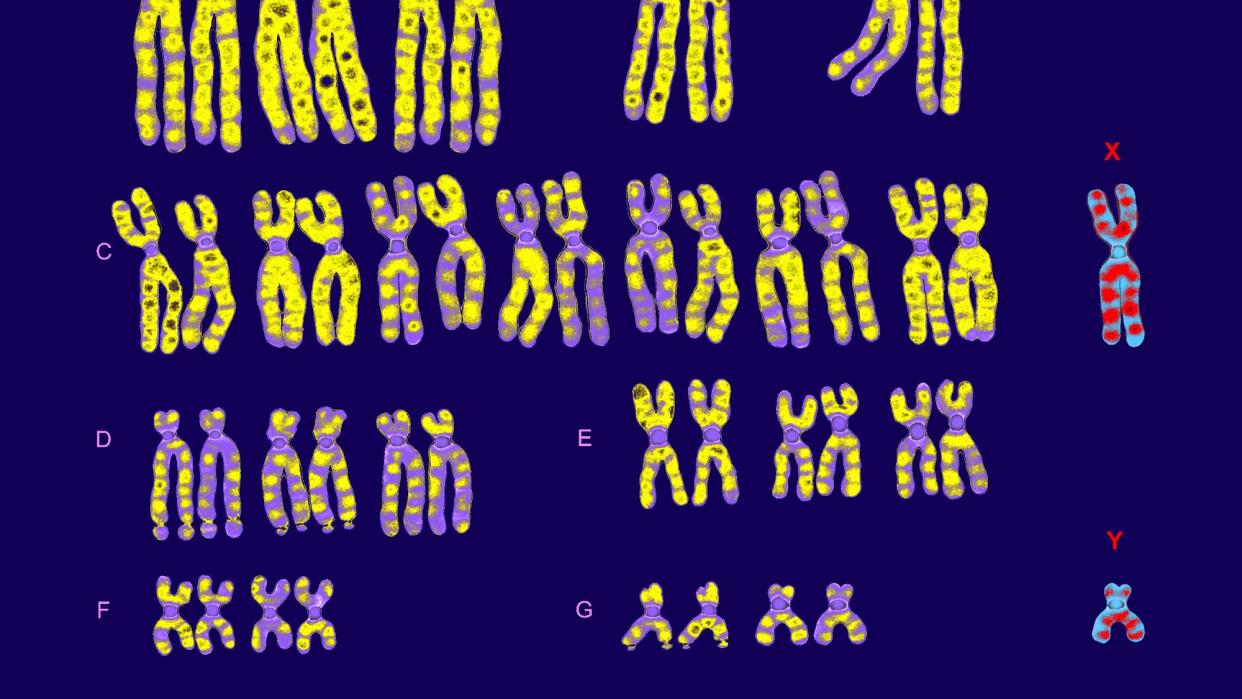  Male karyotype with X and Y chromosomes. 