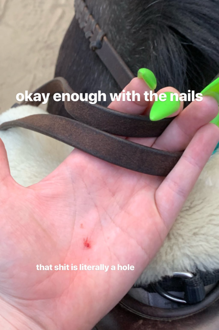 Ouch. Maybe try a less stab-y type of nail next time, Billie. [Photo: Instagram]