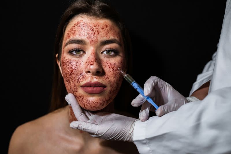 Deux clients aurait attrapé le VIH suite à un soin de visage “vampire” [Photo: Getty]