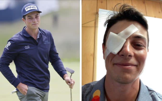 Viktor Hovland (right) with a bandage taped over his eye - EPA/INSTAGRAM