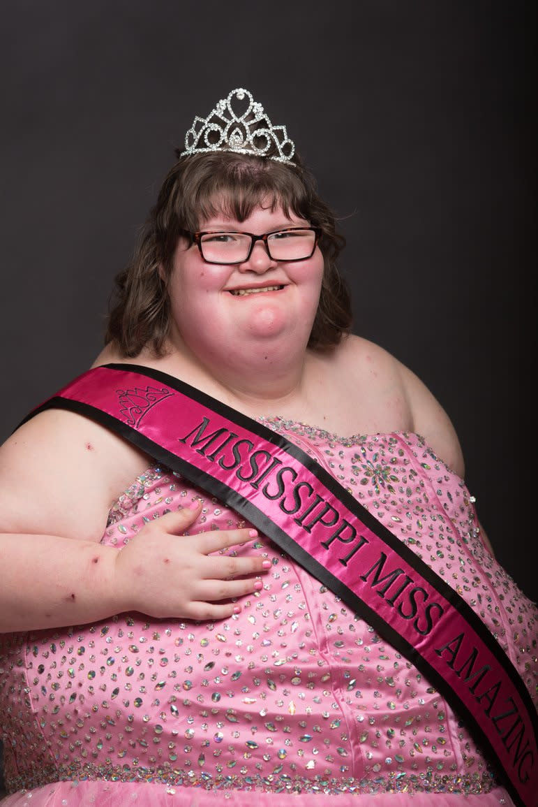 Hankins at the Miss Amazing beauty pageant. (Photo: SWNS)