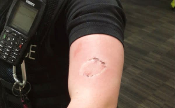 A police officer was bitten while trying to enforce the coronavirus lockdown, Greater Manchester Police said. (Picture: Greater Manchester Police)