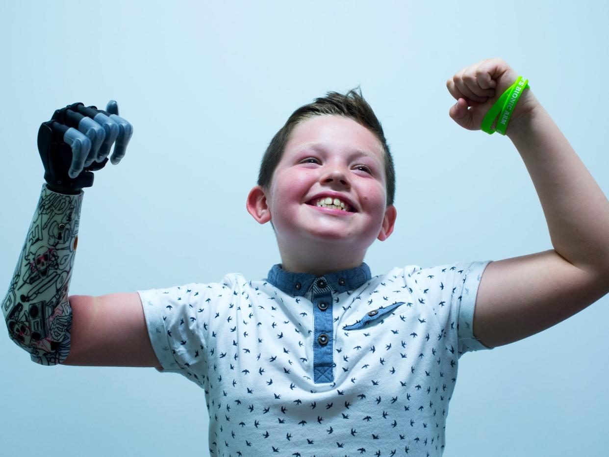 Nine year old Josh Cathcart, who was born with his right arm missing, became the first person in the UK to receive a bionic advanced prosthetic device in 2015  (Mark Runnacles/Getty Images)