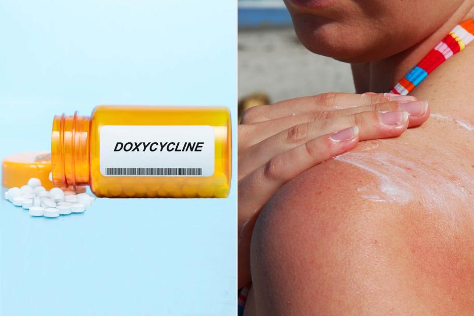 <p>Getty (2)</p> Stock image of doxycycline; stock image of someone applying sunscreen to their shoulder