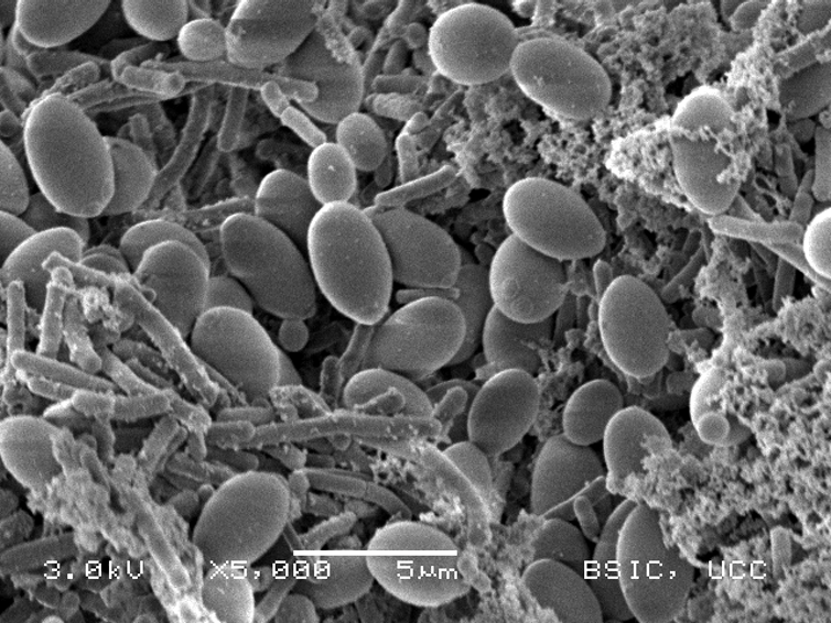 <span class="caption">Milk yeast cells are large and oval and here surrounded by rod-shaped bacterial cells.</span> <span class="attribution"><span class="source">Loughlin Gethins & Suzanne Crotty, UCC</span>, <span class="license">Author provided</span></span>