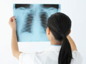 <b>Lung Cancer <p>Who needs testing?</p></b> Smokers who go through at least one pack of cigarettes a day or who suffer a recurring cough or wheeze. Also former heavy smokers. <p><b>What tests to expect:</b> You'll start with a test of your breathing and lung capacity. If the results are abnormal, your doctor may call for a chest CT (computed tomography) scan to detect any tiny malignancies, which may be treatable.</p> <p><b>How often?</b> As recommended by your physician.</p>