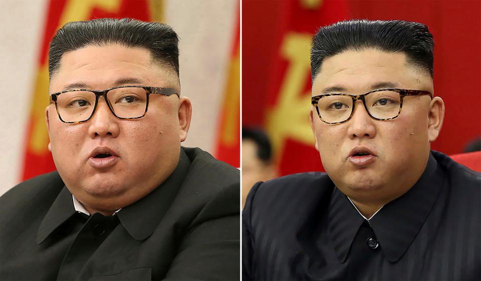 Kim Jong Un weight loss