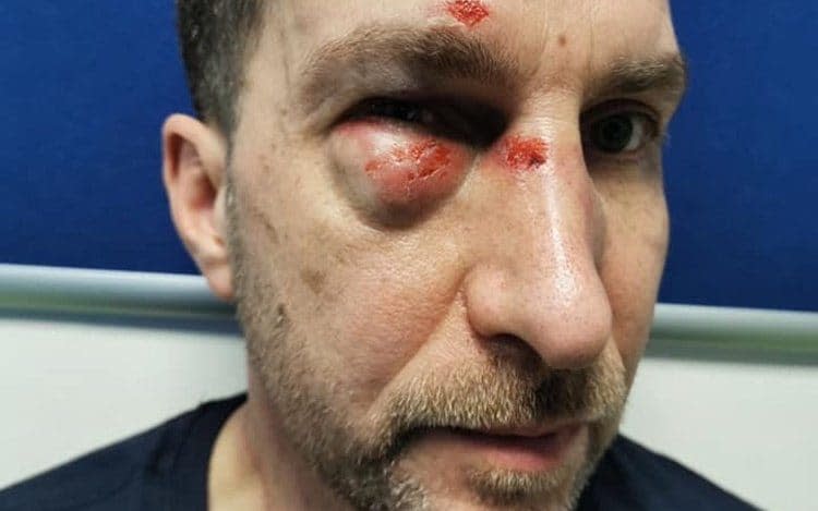 Jamie Hallam was badly beaten in the terrifying attack - Ferrari Press Agency