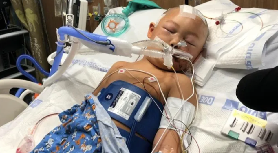 The child was left with multiple skull fractures and swelling to the brain (GoFundMe)