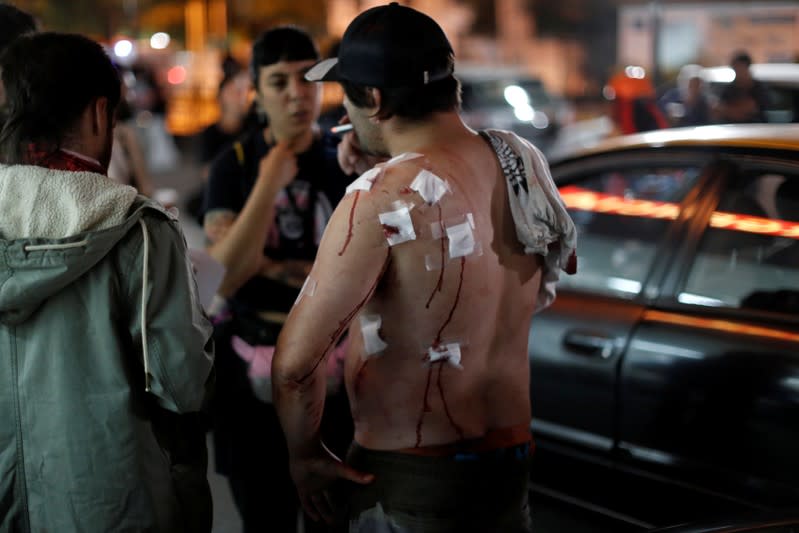 A man smokes outside an emergency room of the hospital after being hit by pellets during a protest against Chile's government in Santiago