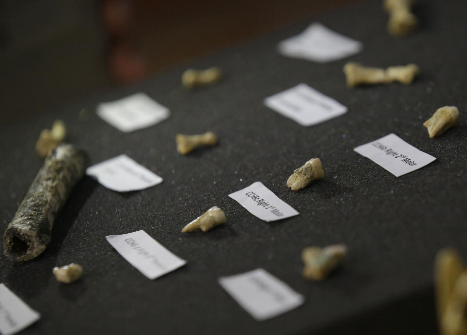 Bones recovered from Callao Cave belonging to a new specie scientists called Homo luzonensis are presented to reporters in metropolitan Manila, Philippines on Thursday, April 11, 2019. Fossil bones and teeth found in Cagayan province, northern Philippines, have revealed a long-lost cousin of modern people, which evidently lived around the time our own species was spreading to Africa to occupy the rest of the world. (AP Photo/Aaron Favila)