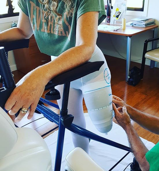 Ms Carden is seen undergoing adjustments for her prosthetic leg.