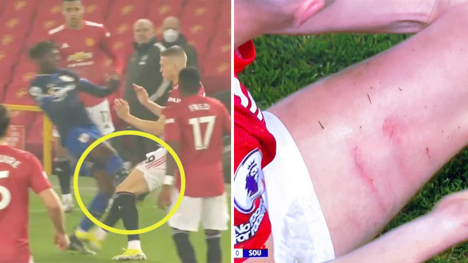 Alexandre Jankewitz tackling Scott McTominay (pictured left) and McTominay's injuries (pictured right).