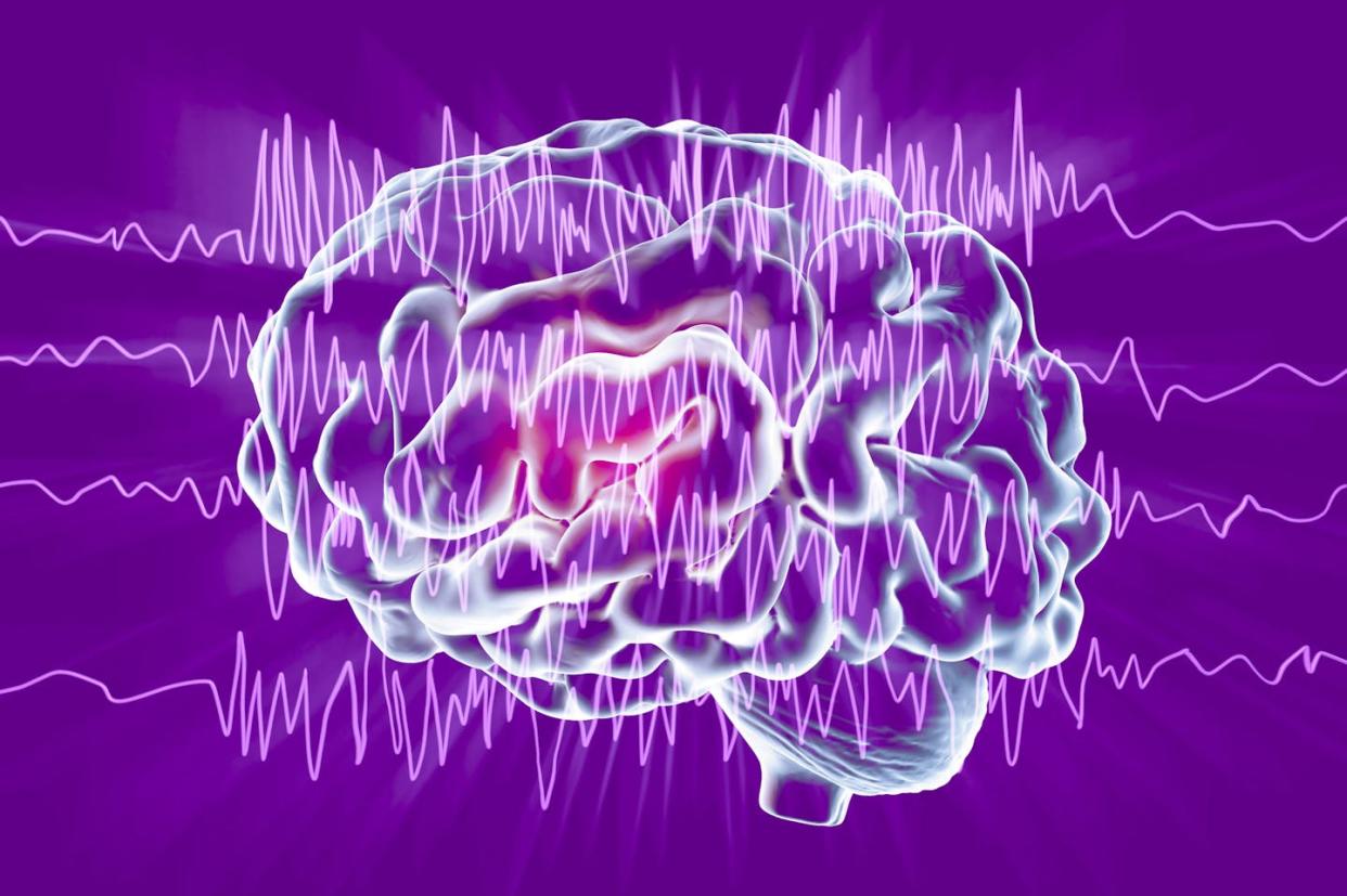 The electroencephalogram allowed scientists to record and read brain activity. <a href="https://www.gettyimages.com/detail/illustration/brain-and-brain-waves-in-epilepsy-royalty-free-illustration/956351642" rel="nofollow noopener" target="_blank" data-ylk="slk:Kateryna Kon/Science Photo Library via Getty Images;elm:context_link;itc:0;sec:content-canvas" class="link ">Kateryna Kon/Science Photo Library via Getty Images</a>