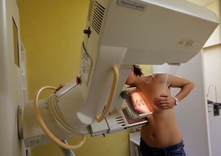 WHAT HAPPENS DURING A MAMMOGRAM? - Mayfair Diagnostics