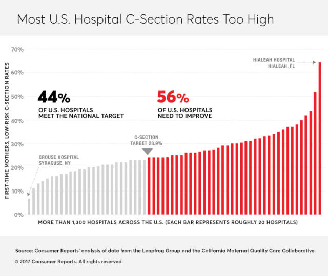 Why C-Section Rates Are So High