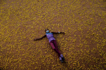 FILE PHOTO: Aidalis Guanipa, 25, a kidney disease patient, poses for a photo after a dialysis session, near her home in La Concepcion, Venezuela, April 26, 2019. REUTERS/Ueslei Marcelino