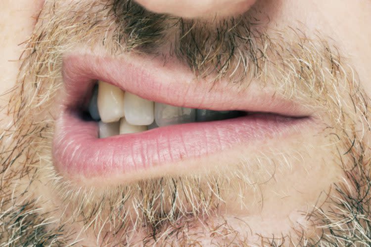 La disminución del flujo salival en situaciones de reposo se conoce comoxerostomía y tiene manifestaciones orgánicas como la afectación de la mucosa oral, caries, patología periodontal, malestar con las prótesis dentales, predisposición a infecciones y halitosis.