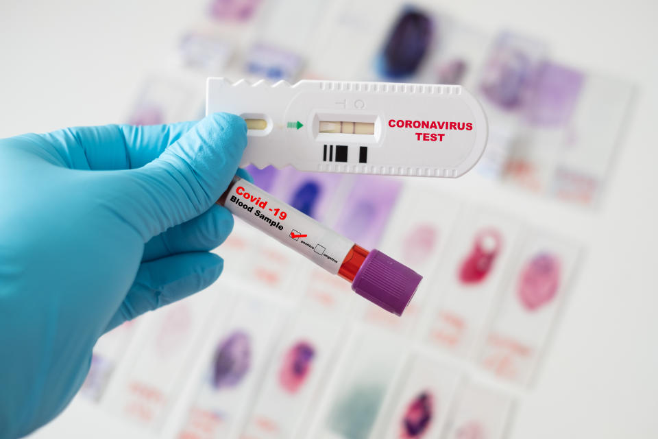 Asian male doctor holding Covid-19 Blood Sample and rapid test of coronavirus on Laboratory Background