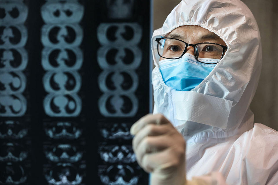 A doctor looking at a lung CT image of a patient with coronavirus. Over two dozen doctors have posted an open letter disputing the conspiracy theories suggesting the virus was engineered as a bioweapon in a lab near Wuhan. (Photo by STR/AFP via Getty Images)