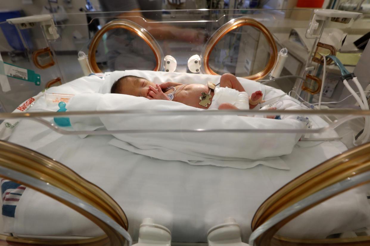 Two day-old David Alejandro Vega was being treated in the neonatal intensive care unit at Doctors Hospital at Renaissance in Edinbug, Texas. His mother, Mayra Vega, who tested positive for COVID, had been unable to hold or see him except via video. (Photo: Carolyn Cole/Los Angeles Times via Getty Images)