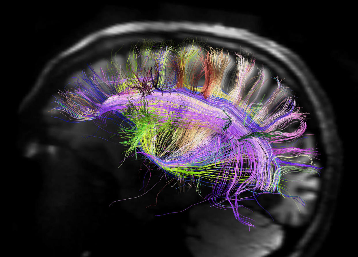 brain scan, human connectome project, fibers