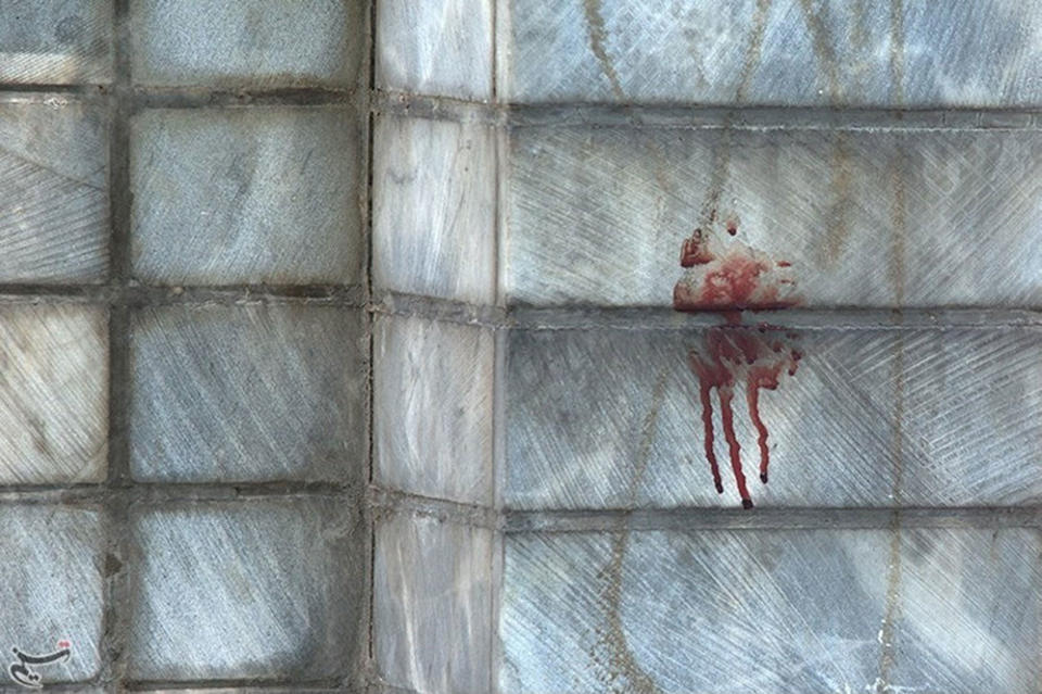 Blood is seen at the scene