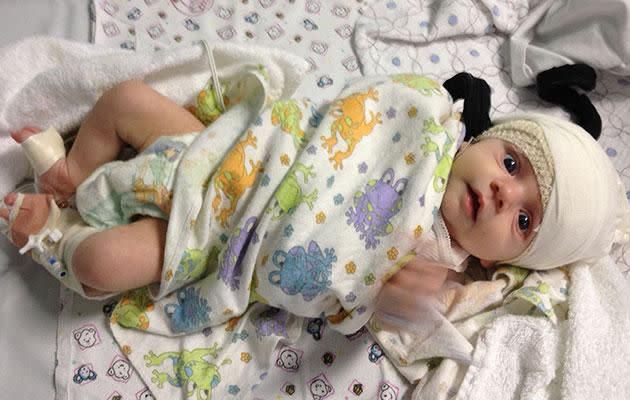 Evelyn started having seizures at eight weeks old. Photo: Supplied