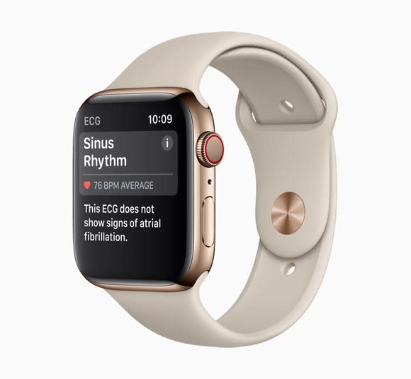 An Apple Watch displaying a sinus rhythm reading.