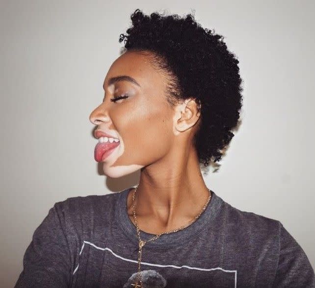 Winnie Harlow Instagram